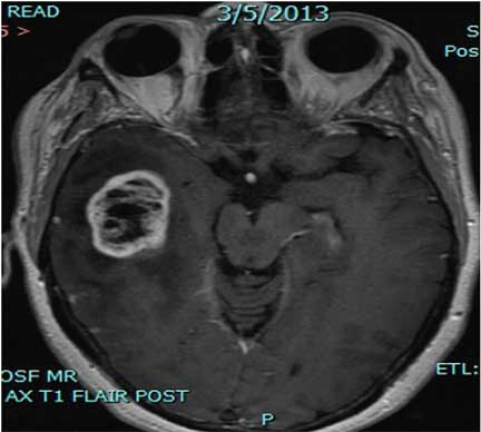 Clinical Trials Investigate Novel Treatment Methods in ...