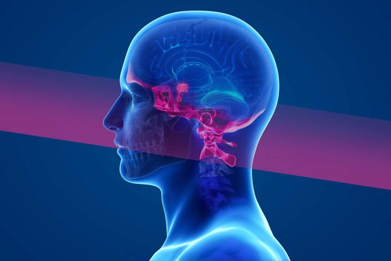 Penn State Health Takes Multidisciplinary Approach to Treating Skull