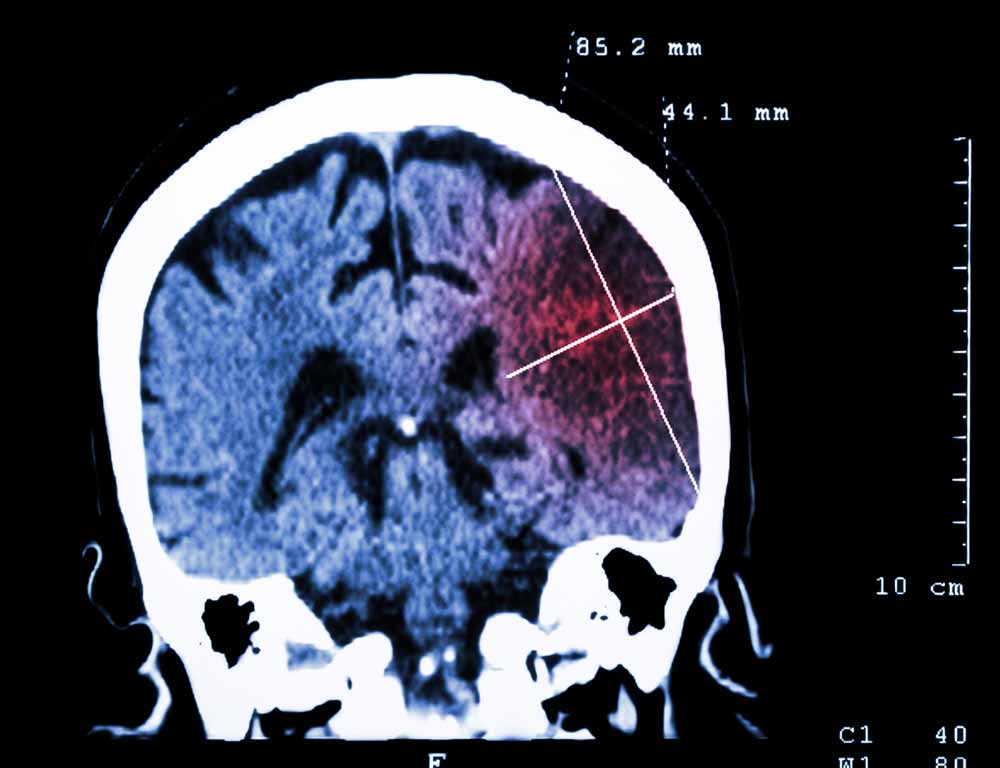 Radiologic image of the brain.